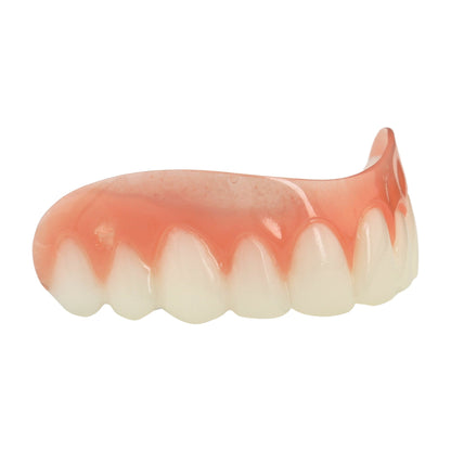 Great Smile Veneer (Upper Only)