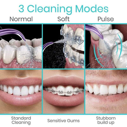 Water Flosser - water-flosser