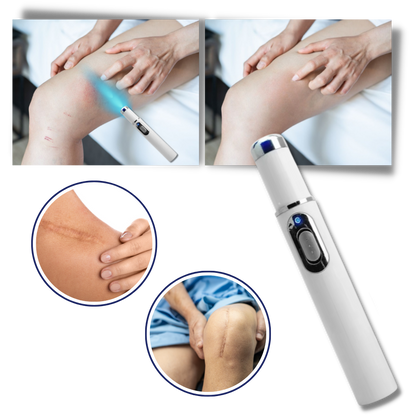LumaGlow™ Dark Spot Remover Pen - Blue Light Laser Treatment for Skin Blemishes