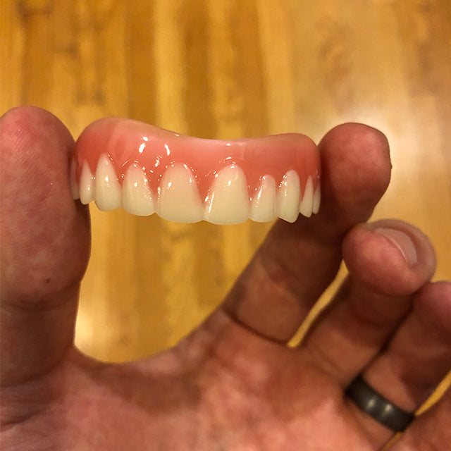 Great Smile Veneer (Upper Only) - Default Title - great-smile-veneer-upper-only